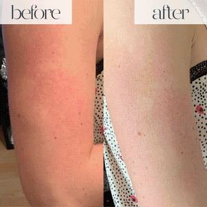 IPL Hair Removal Device 999999 Flashes Permanent Hair Removal Treatment for Women & Men